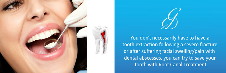 root_canal_treatment