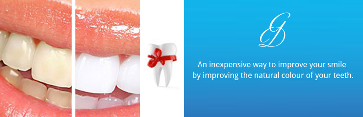 tooth_whitening