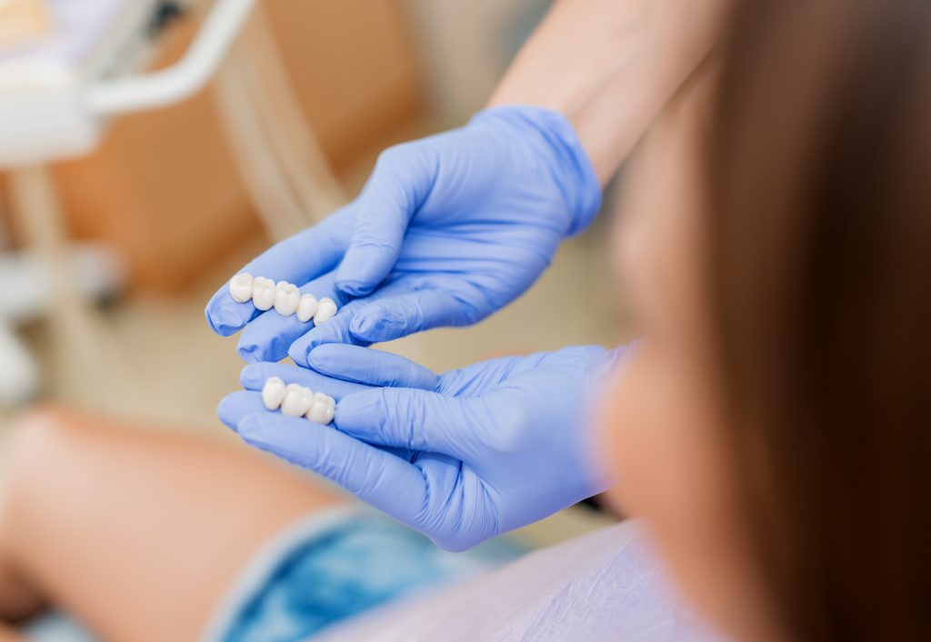 Dentist showing porcelain crowns to the patient